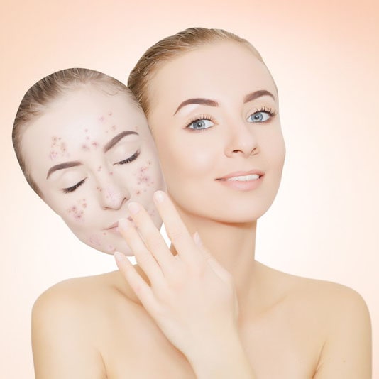 美容皮膚科の水光注射で肌にハリや弾力を与えることが出来る